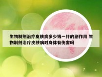 生物制剂治疗皮肤病多少钱一针的副作用 生物制剂治疗皮肤病对身体有伤害吗