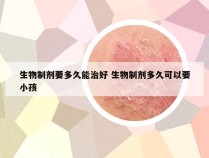 生物制剂要多久能治好 生物制剂多久可以要小孩