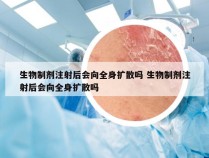 生物制剂注射后会向全身扩散吗 生物制剂注射后会向全身扩散吗