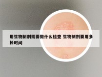 用生物制剂需要做什么检查 生物制剂要用多长时间