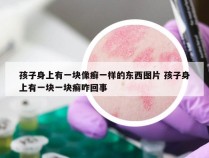 孩子身上有一块像癣一样的东西图片 孩子身上有一块一块癣咋回事