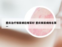 重庆治疗银屑病在哪家好 重庆银屑病排名第一