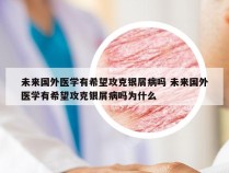 未来国外医学有希望攻克银屑病吗 未来国外医学有希望攻克银屑病吗为什么