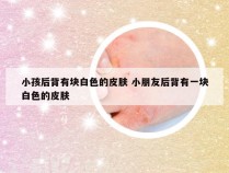 小孩后背有块白色的皮肤 小朋友后背有一块白色的皮肤