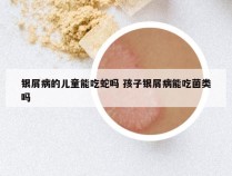 银屑病的儿童能吃蛇吗 孩子银屑病能吃菌类吗