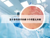 五个多月孩子长癣 5个月婴儿长癣