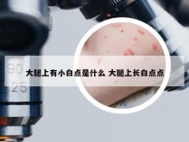 大腿上有小白点是什么 大腿上长白点点