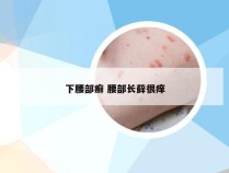 下腰部癣 腰部长藓很痒