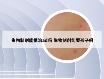 生物制剂能根治ad吗 生物制剂能要孩子吗