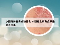 小孩身体有白点缺什么 小孩身上有白点子是怎么回事