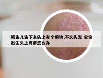 新生儿生下来头上有个癣块,不长头发 宝宝出生头上有癣怎么办