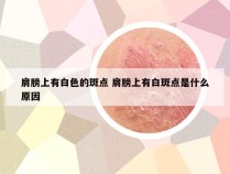 肩膀上有白色的斑点 肩膀上有白斑点是什么原因