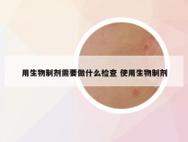 用生物制剂需要做什么检查 使用生物制剂