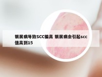 银屑病导致SCC偏高 银屑病会引起scc值高到15