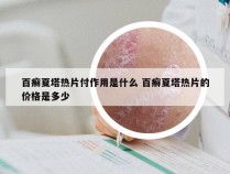 百癣夏塔热片付作用是什么 百癣夏塔热片的价格是多少