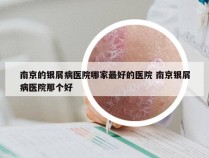 南京的银屑病医院哪家最好的医院 南京银屑病医院那个好