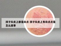 孩子头皮上都是白点 孩子头皮上有白点点是怎么回事