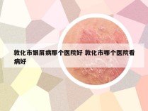 敦化市银屑病那个医院好 敦化市哪个医院看病好