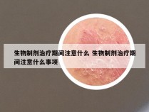 生物制剂治疗期间注意什么 生物制剂治疗期间注意什么事项