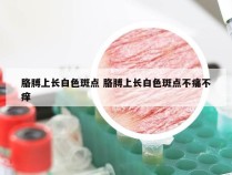 胳膊上长白色斑点 胳膊上长白色斑点不痛不痒