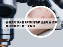 百癣夏塔热片什么时候吃饭前还是饭后 百癣夏塔热片吃几盒一个疗程