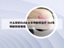 什么样的ibd适合生物制剂治疗 ibd生物制剂有哪些