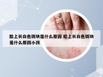 脸上长白色斑块是什么原因 脸上长白色斑块是什么原因小孩