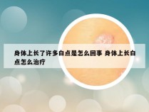 身体上长了许多白点是怎么回事 身体上长白点怎么治疗