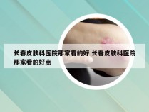 长春皮肤科医院那家看的好 长春皮肤科医院那家看的好点