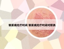 银屑病光疗时间 银屑病光疗时间对照表