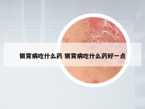 银霄病吃什么药 银霄病吃什么药好一点