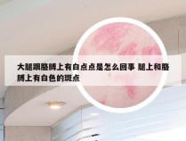 大腿跟胳膊上有白点点是怎么回事 腿上和胳膊上有白色的斑点