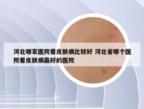 河北哪家医院看皮肤病比较好 河北省哪个医院看皮肤病最好的医院