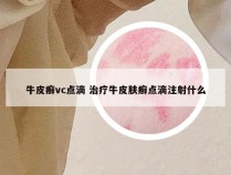 牛皮癣vc点滴 治疗牛皮肤癣点滴注射什么