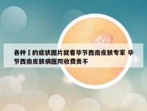 各种廯的症状图片就看毕节西南皮肤专家 毕节西南皮肤病医院收费贵不