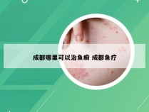 成都哪里可以治鱼癣 成都鱼疗