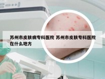 苏州市皮肤病专科医院 苏州市皮肤专科医院在什么地方