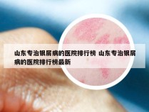 山东专治银屑病的医院排行榜 山东专治银屑病的医院排行榜最新