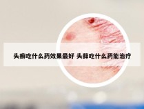 头癣吃什么药效果最好 头藓吃什么药能治疗