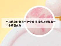 小孩头上好象有一个个癣 小孩头上好象有一个个癣怎么办