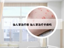 仙人掌治疗癣 仙人掌治疗手癣吗