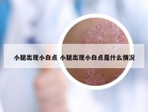 小腿出现小白点 小腿出现小白点是什么情况