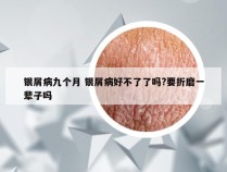 银屑病九个月 银屑病好不了了吗?要折磨一辈子吗