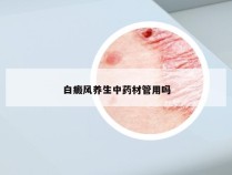 白癜风养生中药材管用吗