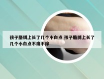 孩子胳膊上长了几个小白点 孩子胳膊上长了几个小白点不痛不痒