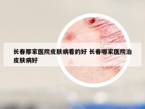 长春那家医院皮肤病看的好 长春哪家医院治皮肤病好