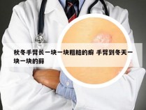 秋冬手臂长一块一块粗糙的癣 手臂到冬天一块一块的藓