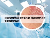 阿达木单抗银屑病效果不好 阿达木单抗治疗银屑病的副反应