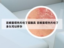 百癣夏塔热片吃了尿酸高 百癣夏塔热片吃了多久可以怀孕