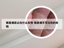 银屑病禁止吃什么食物 银屑病不可以吃的食物